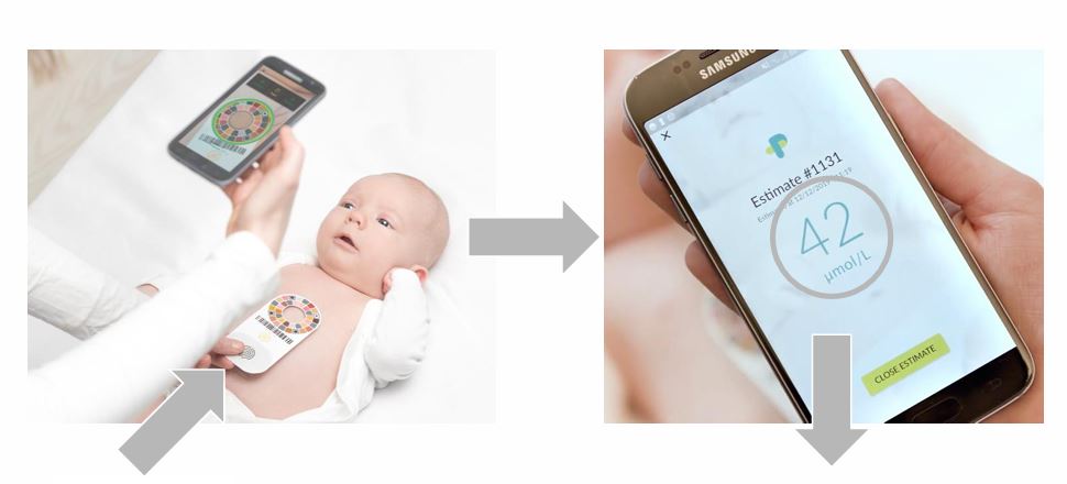 Screening for Neonatal Jaundice by optical measurement of bilirubin levels