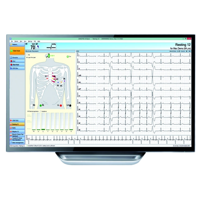 PC Based ECG Machine with 12 Channels – GENTREX INTERNATIONAL MEDICAL ...