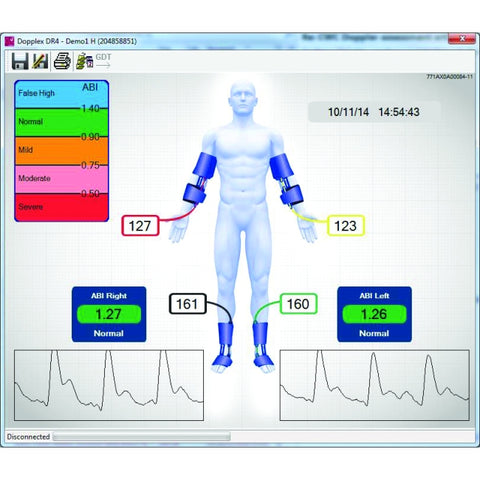 Huntleigh Dopplex Ability Doppler EABI