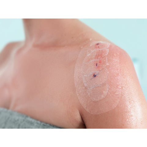 Leukomed Control Waterproof Island Dressing 7cm X 10cm Sterile